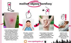 Borelioza objawy psychiczne: jak choroba wpływa na zdrowie psychiczne i co robić