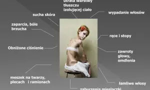 Anoreksja objawy psychiczne: Jak niska samoocena wpływa na zdrowie?