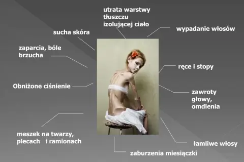 Anoreksja objawy psychiczne: Jak niska samoocena wpływa na zdrowie?