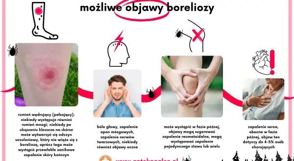 Borelioza objawy psychiczne: jak choroba wpływa na zdrowie psychiczne i co robić